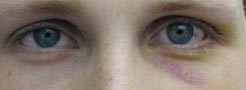 Blaue Augen